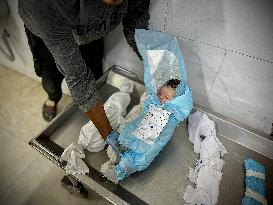 Children Die Amid Malnutrition in Khan Yunis - Palestine