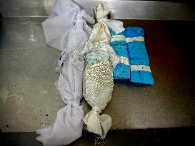 Children Die Amid Malnutrition in Khan Yunis - Palestine