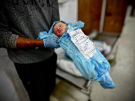 Children Die Amid Malnutrition in Khan Yunis - Palestine