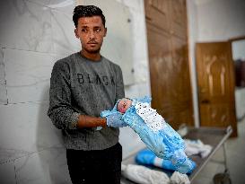 Children Die Amid Malnutrition in Khan Yunis - Palestine