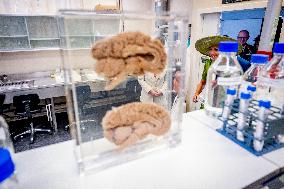 Queen Maxima Visits Netherlands Brain Bank - Amsterdam