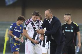 CALCIO - Serie A - Hellas Verona FC vs Juventus FC