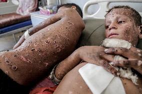 Injured Gaza Children - Palestine