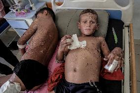 Injured Gaza Children - Palestine
