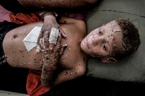 Injured Gaza Children - Palestine