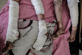 Injured Gaza Children - Palestine
