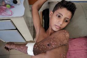 Injured Gaza Children - Palestine