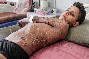 Injured Gaza Children - Palestine