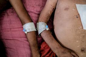 Injured Gaza Children - Palestine