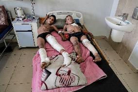 Injured Gaza Children - Palestine