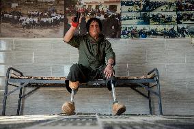 Iraqi Deminer Loses Legs Clearing Mines - Iraq