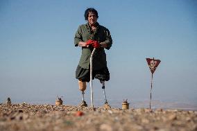 Iraqi Deminer Loses Legs Clearing Mines - Iraq