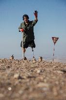 Iraqi Deminer Loses Legs Clearing Mines - Iraq