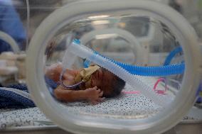 Palestinian Children Wait to Go Abroad to Receive Medical Treatment - Gaza