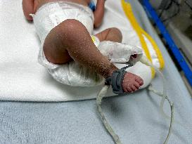 Infant Dead Because of Hypothermia - Gaza