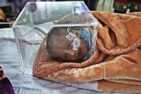 Pneumonia Patients Rise During The Winter Season - Dhaka